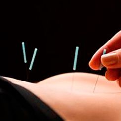 Fisalud Fisioterapia acupuntura